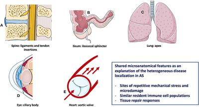 The Early Phases of Ankylosing Spondylitis: Emerging Insights From Clinical and Basic Science